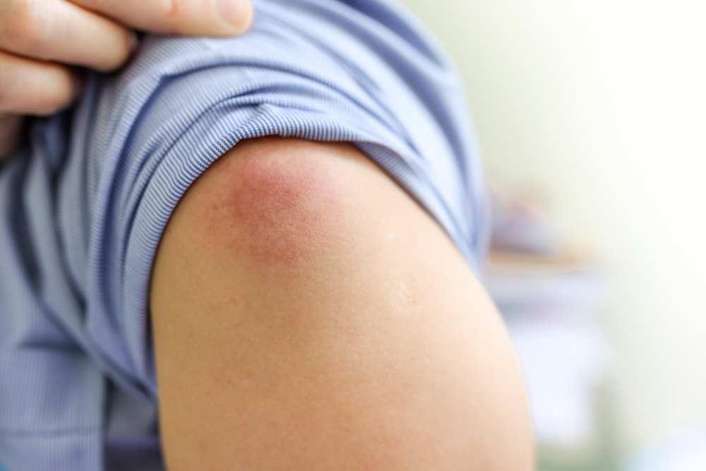 عوارض واکسن انفولانزا