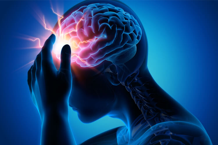 بیماری صرع چیست؟ علائم+علت +روش درمان قطعی صرع
